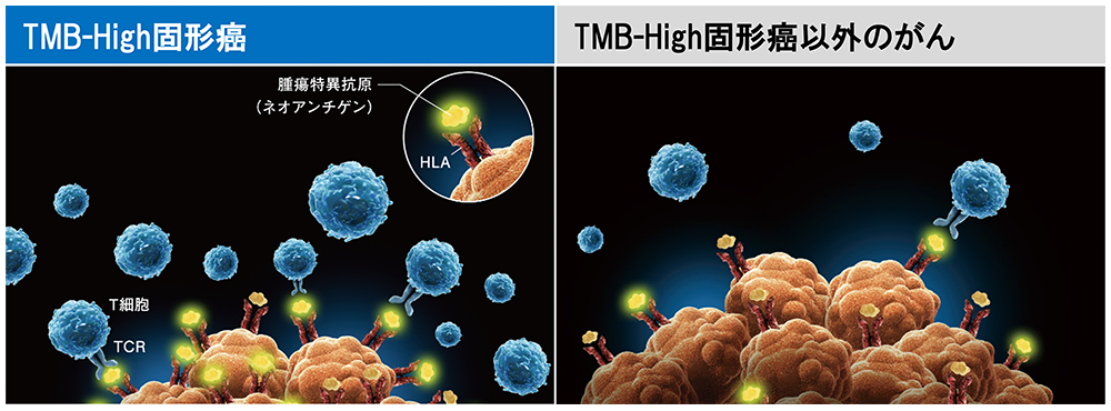 TMB-High固形癌