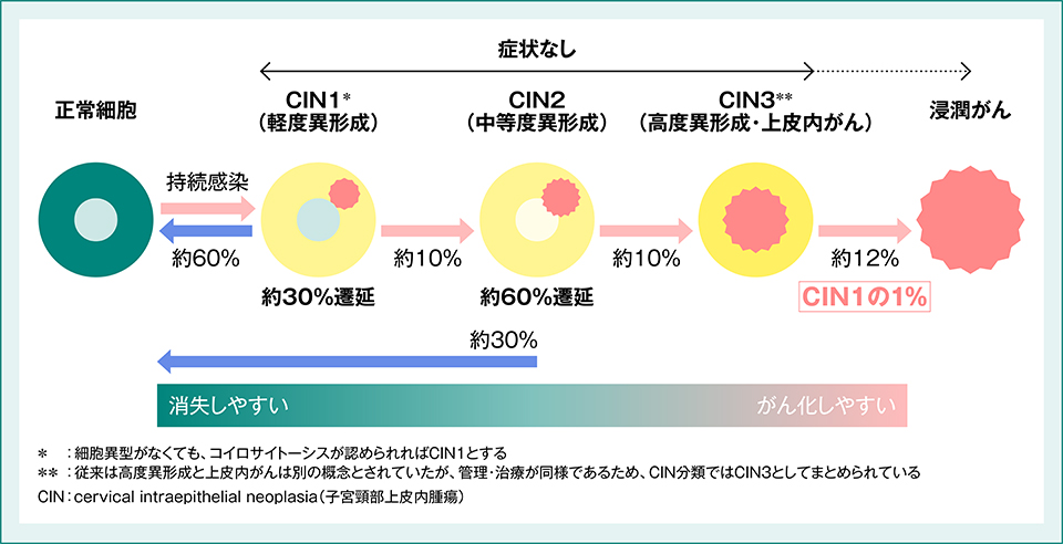 HPV感染と子宮頸がんへの進行