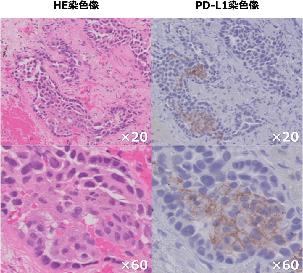 HE染色像・PD-L1染色像