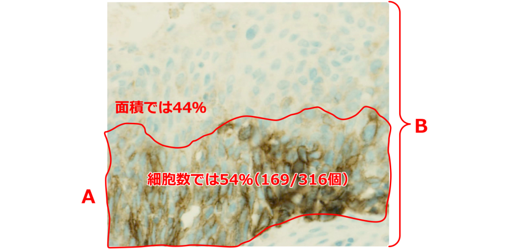 PD-L1染色像