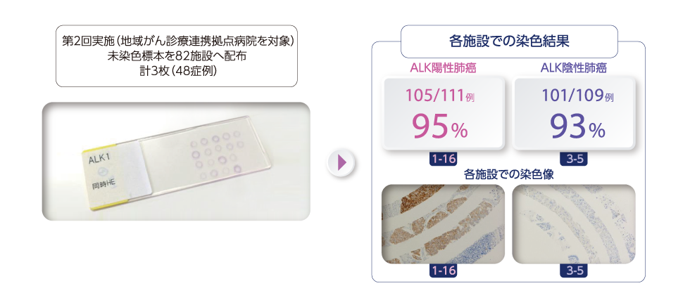診断薬別にみたALK免疫染色