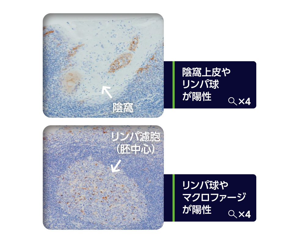 陽性コントロール(扁󠄀桃組織)