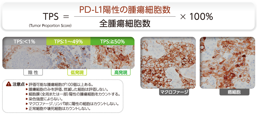 22C3抗体を用いたPD-L1免疫染色の判定