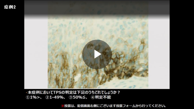 エキスパートが解説!TPS判定のコツ
