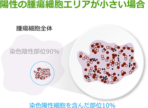 陽性の腫瘍細胞エリアが小さい場合