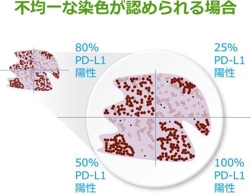 不均一な染色が認められる場合