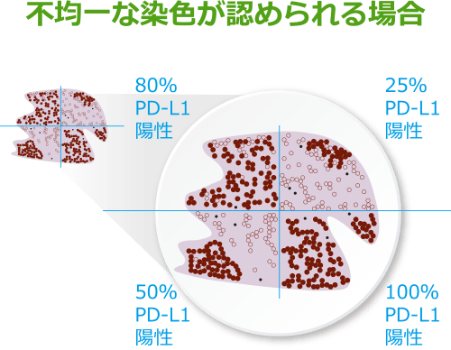 不均一な染色が認められる場合