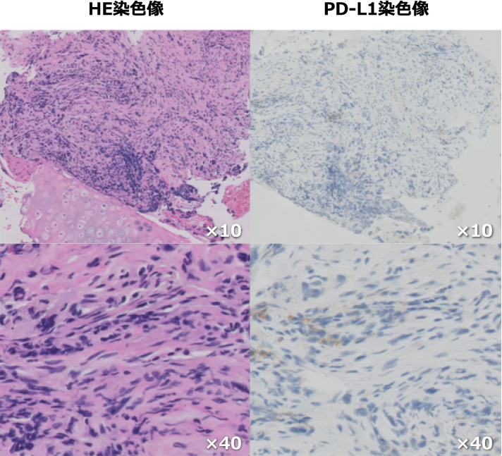 HE染色像・PD-L1染色像