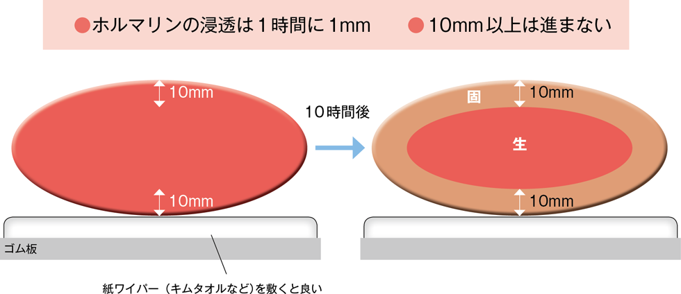 大きな検体を固定する際の注意点