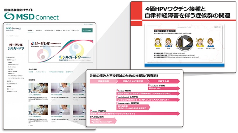 MSDコネクト HPVワクチンコンテンツ