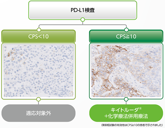 キイトルーダ®の治療対象の判定基準