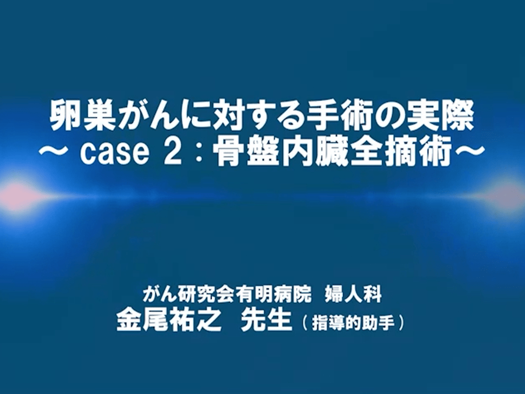 【卵巣癌】卵巣がんに対する手術の実際 〜case 2：骨盤内臓全摘術〜
