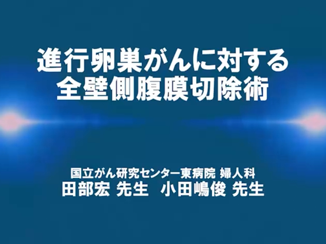 【卵巣癌】 進⾏卵巣がんに対する全壁側腹膜切除術