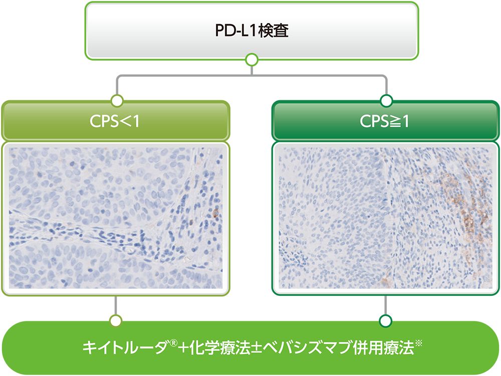 キイトルーダ®の治療対象の判定基準