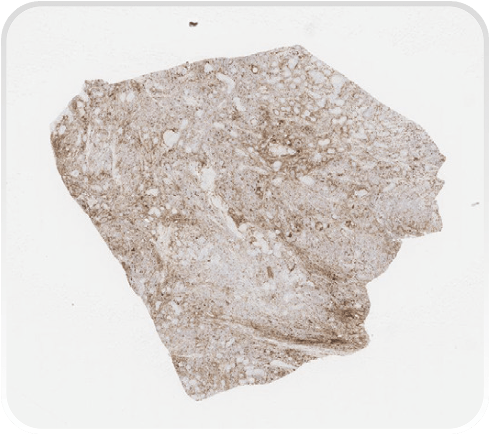 弱拡大像にて切片全体を検鏡し、発色領域の有無を判断する。