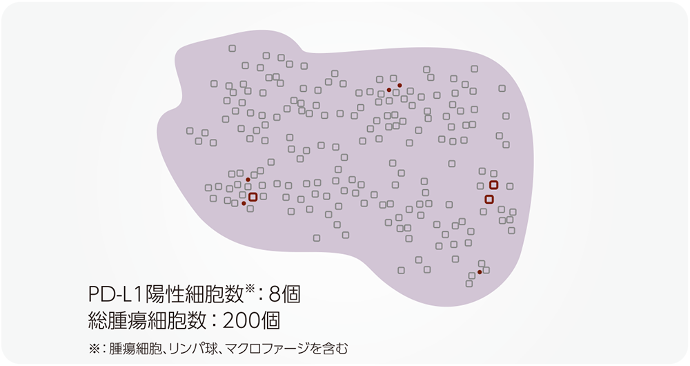 陽性細胞が少ないものの、標本全体に均一に散在しているパターン