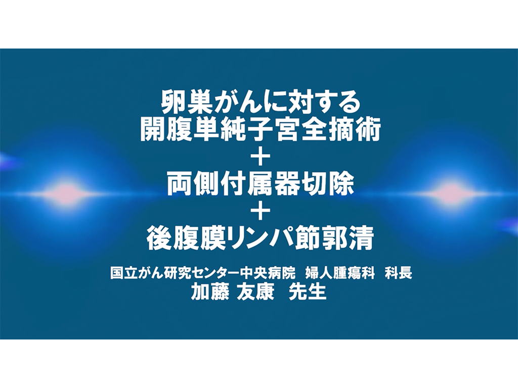 【卵巣癌】卵巣がんに対する開腹単純⼦宮全摘術＋両側付属器切除＋後腹膜リンパ節郭清