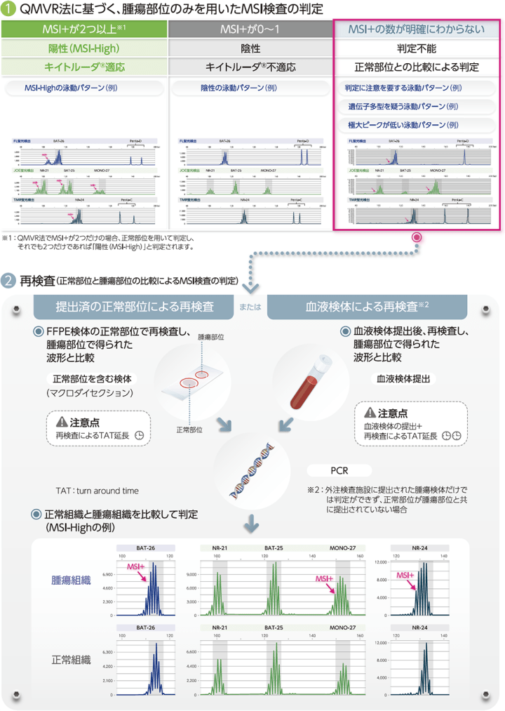 MSI検査の判定