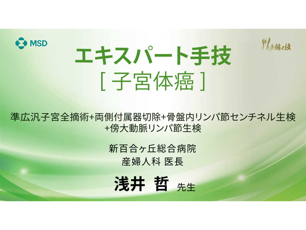 【⼦宮体癌】エキスパート⼿技 準広汎⼦宮全摘術＋両側付属器切除＋⾻盤内リンパ節センチネル⽣検＋傍⼤動脈リンパ節⽣検