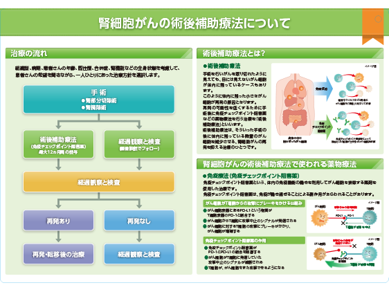 キイトルーダ® インフォームドコンセント用資料患者説明用下敷き：＜腎細胞癌｜術後補助療法＞