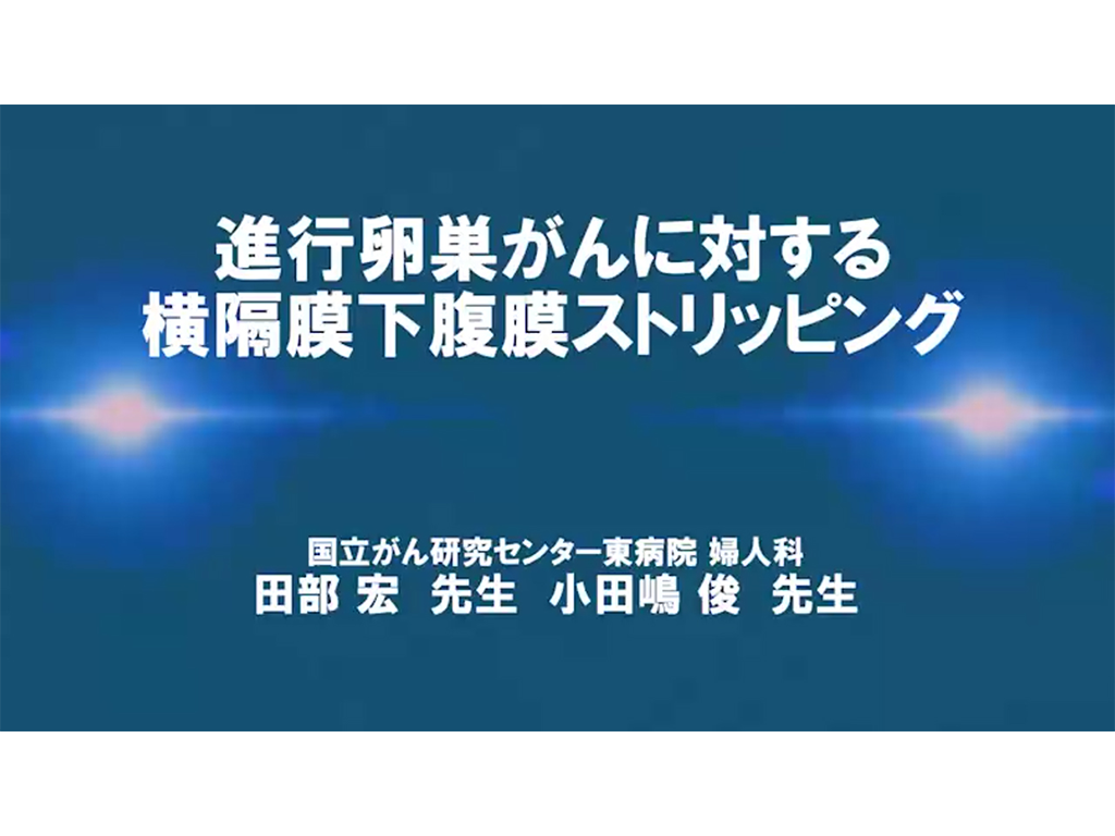 Professional Surgery for Gynecology【卵巣癌】進⾏卵巣がんに対する横隔膜下腹膜ストリッピング