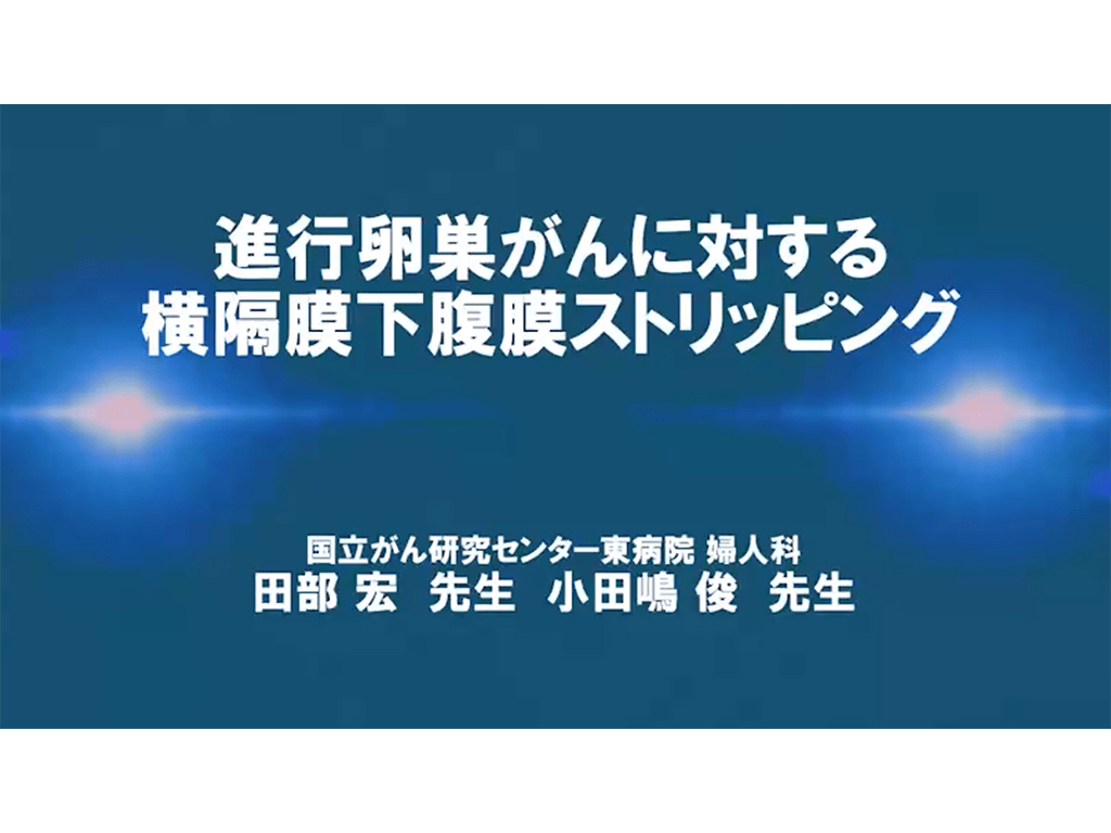 Professional Surgery for Gynecology【卵巣癌】進⾏卵巣がんに対する横隔膜下腹膜ストリッピング