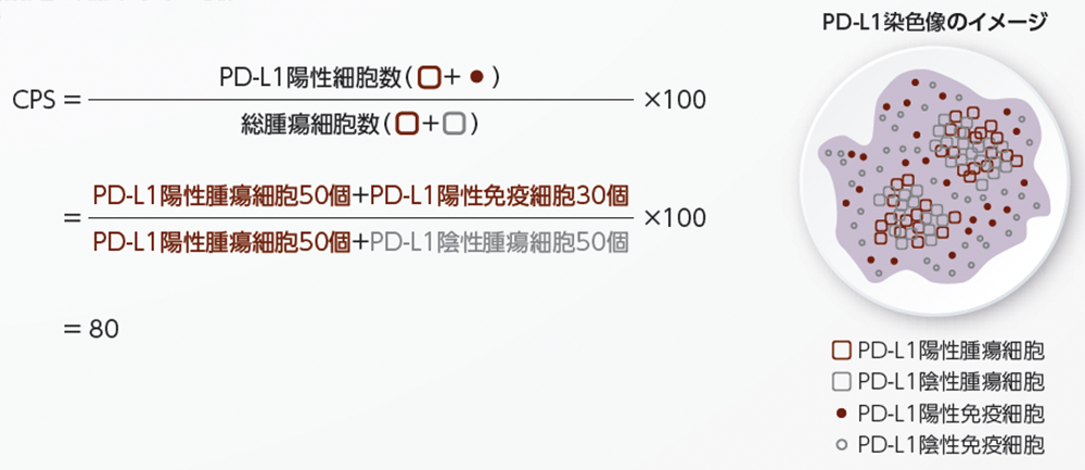 CPS計算のイメージ