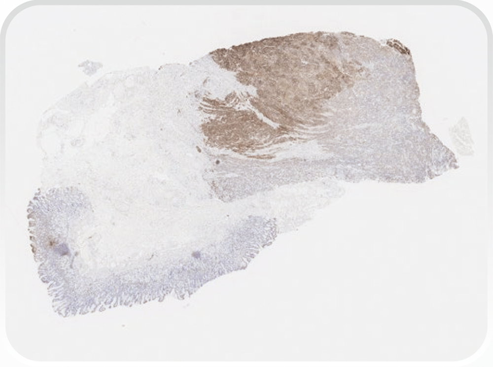 弱拡大像にて切片全体を検鏡し、発色領域の有無を判断する。