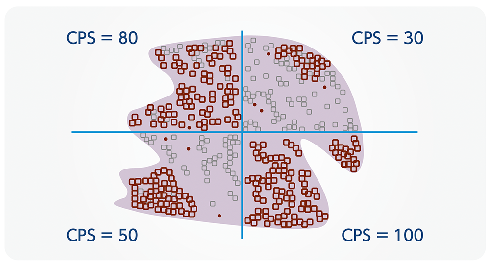 陽性細胞が不均一に分布しているパターン