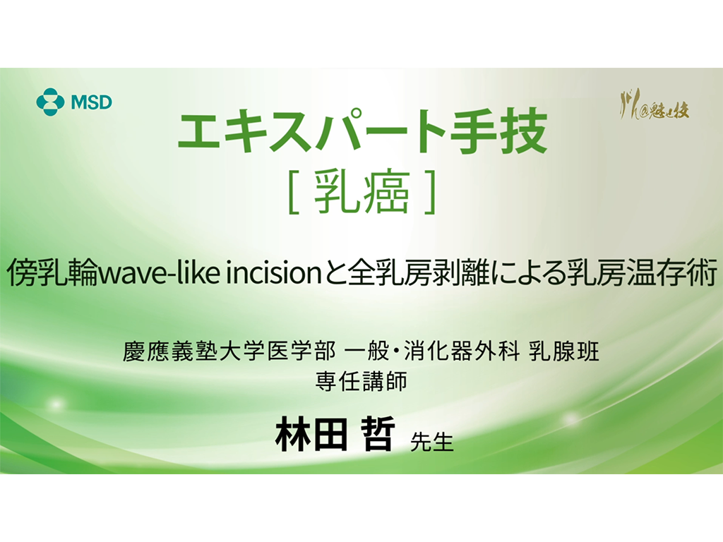 【乳癌】エキスパート⼿技 傍乳輪wave-like incisionと全乳房剥離による乳房温存術