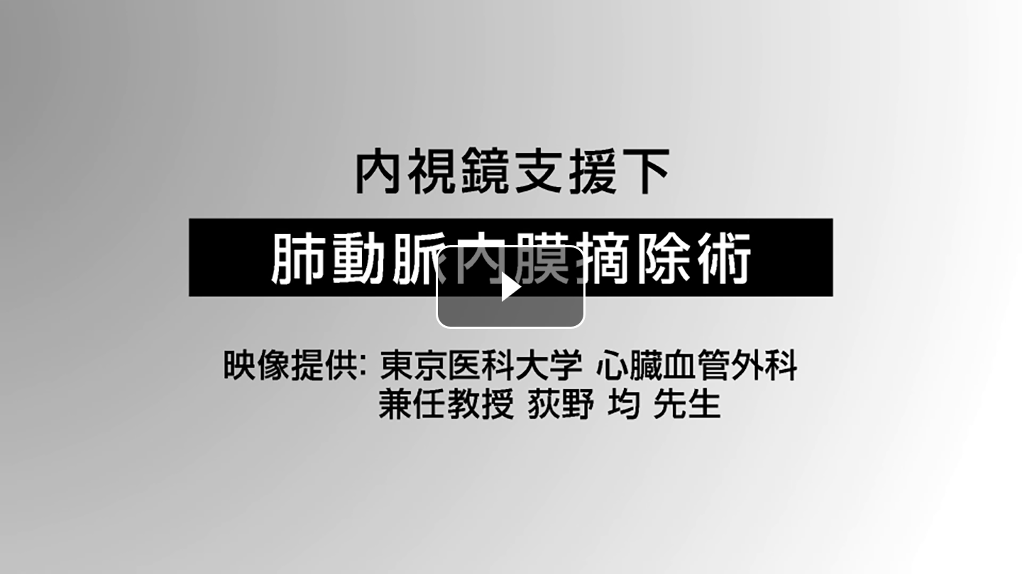内視鏡支援下肺動脈内膜摘除術