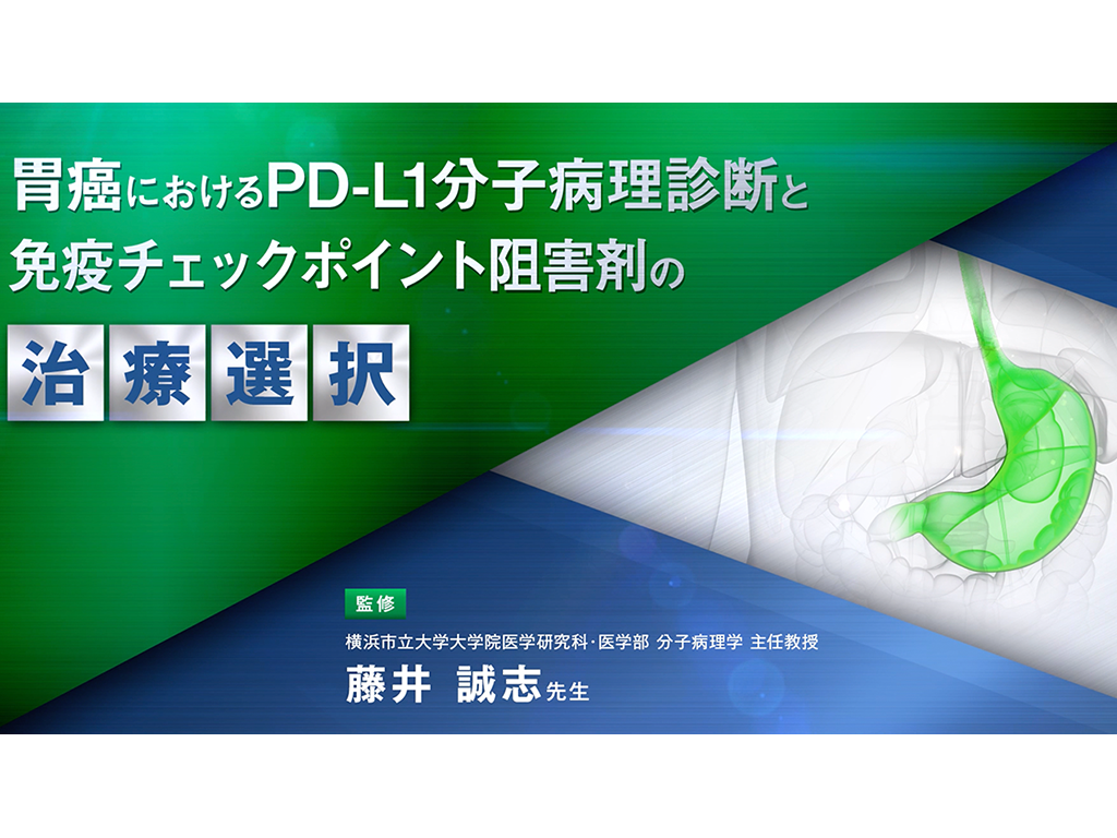 【Biomarker】胃癌におけるPD-L1分⼦病理診断と免疫チェックポイント阻害剤の治療選択