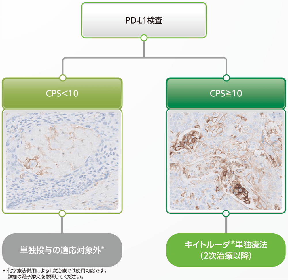 がん化学療法後に増悪した根治切除不能な進行・再発の食道扁平上皮癌におけるキイトルーダ®治療対象の判定基準