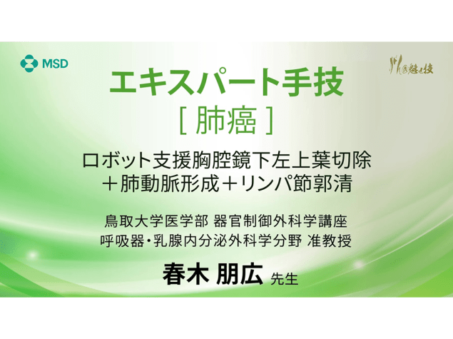 【肺癌】エキスパート⼿技 ロボット⽀援胸腔鏡下左上葉切除＋肺動脈形成＋リンパ節郭清