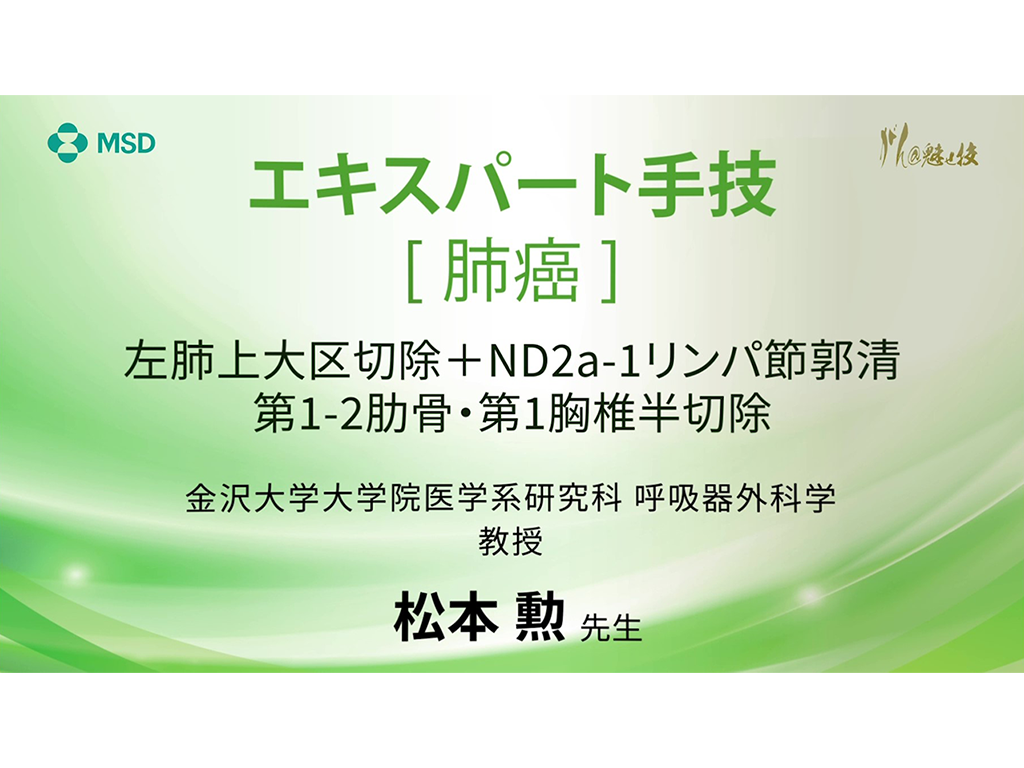 【肺癌】エキスパート⼿技 左肺上⼤区切除＋ND2a-1リンパ節郭清 第1-2肋⾻・第1胸椎半切除