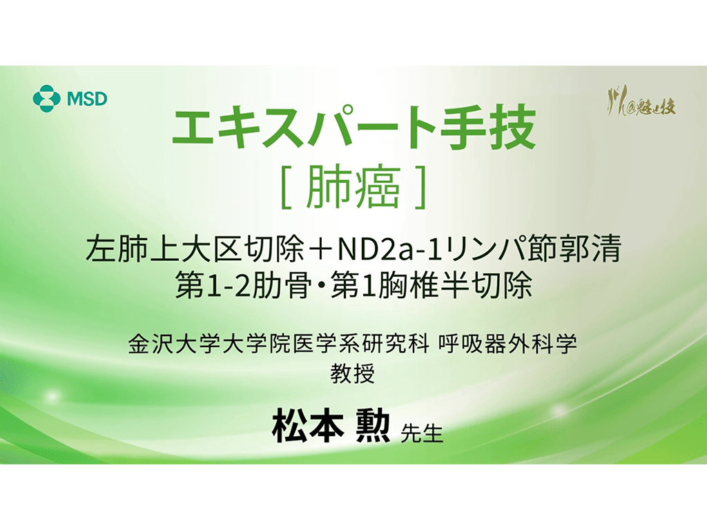 【肺癌】エキスパート⼿技 左肺上⼤区切除＋ND2a-1リンパ節郭清 第1-2肋⾻・第1胸椎半切除