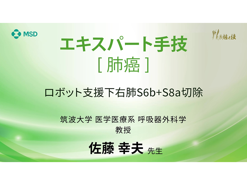 【肺癌】エキスパート⼿技 ロボット⽀援下右肺S6b＋S8a切除