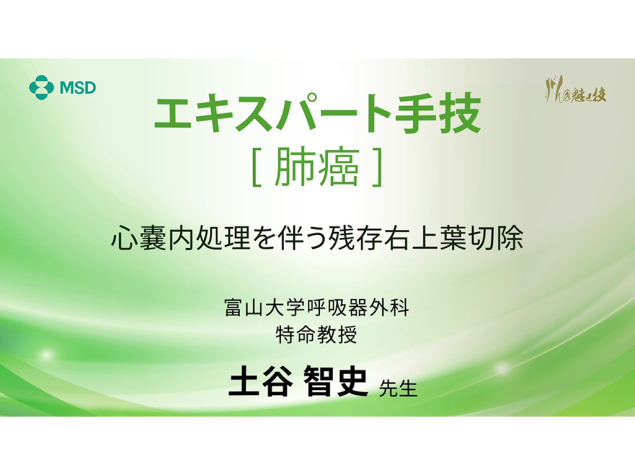 【肺癌】エキスパート⼿技 ⼼嚢内処理を伴う残存右上葉切除
