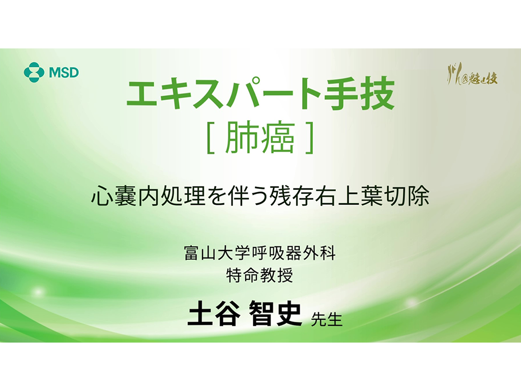 【肺癌】エキスパート⼿技 ⼼嚢内処理を伴う残存右上葉切除