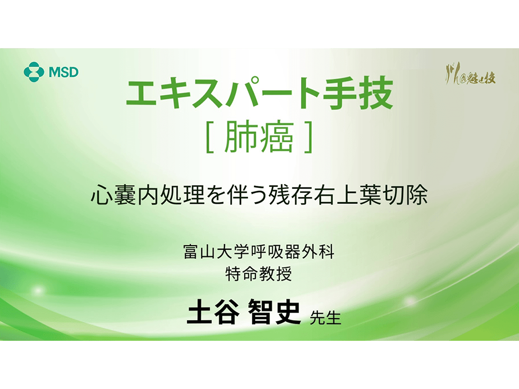 【肺癌】エキスパート⼿技 ⼼嚢内処理を伴う残存右上葉切除