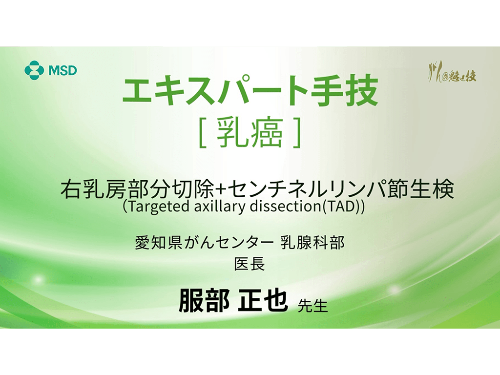 【乳癌】エキスパート手技 右乳房部分切除+センチネルリンパ節生検（Targeted axillary dissection (TAD)）