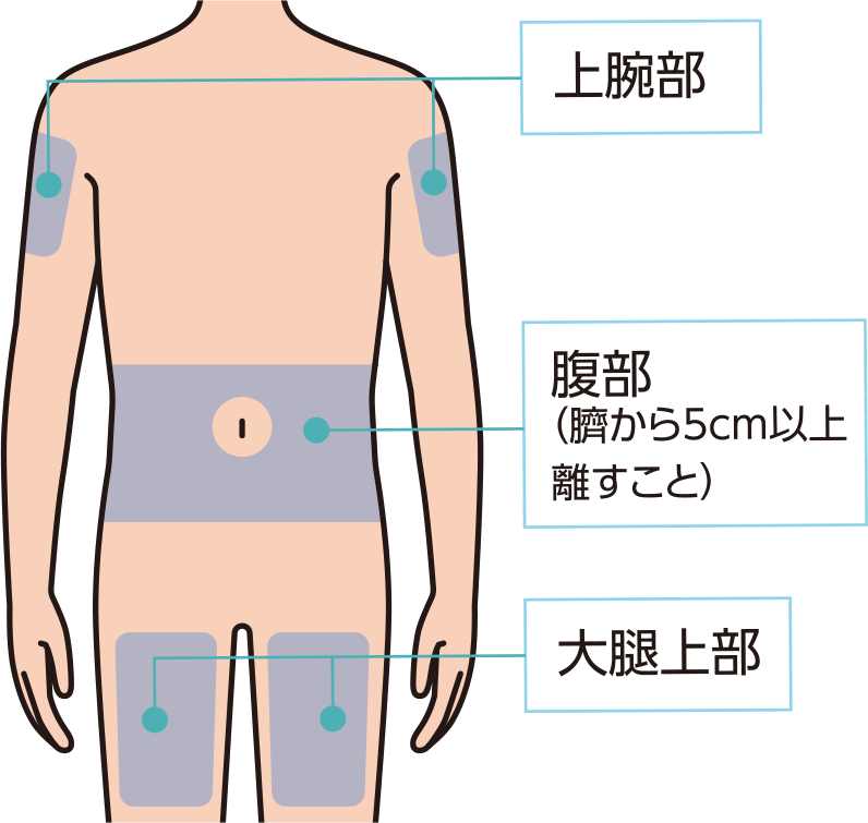 上腕部、臍から5cm以上離した腹部、大腿部のいずれかを選択します