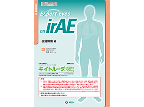 Expert Eyes on irAE