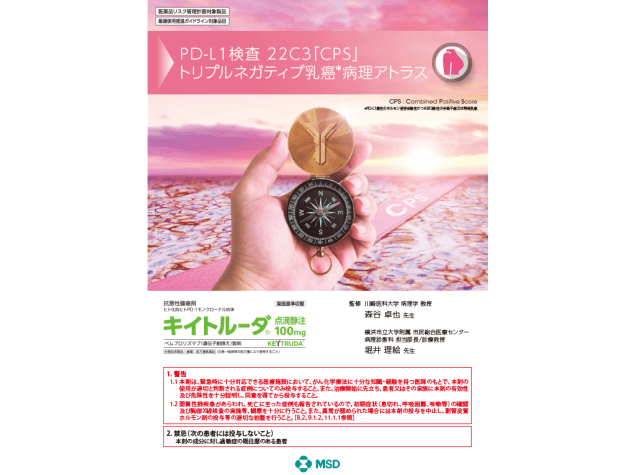 キイトルーダⓇPD-L1検査 22C3「CPS」病理アトラス：＜乳癌＞再発・転移