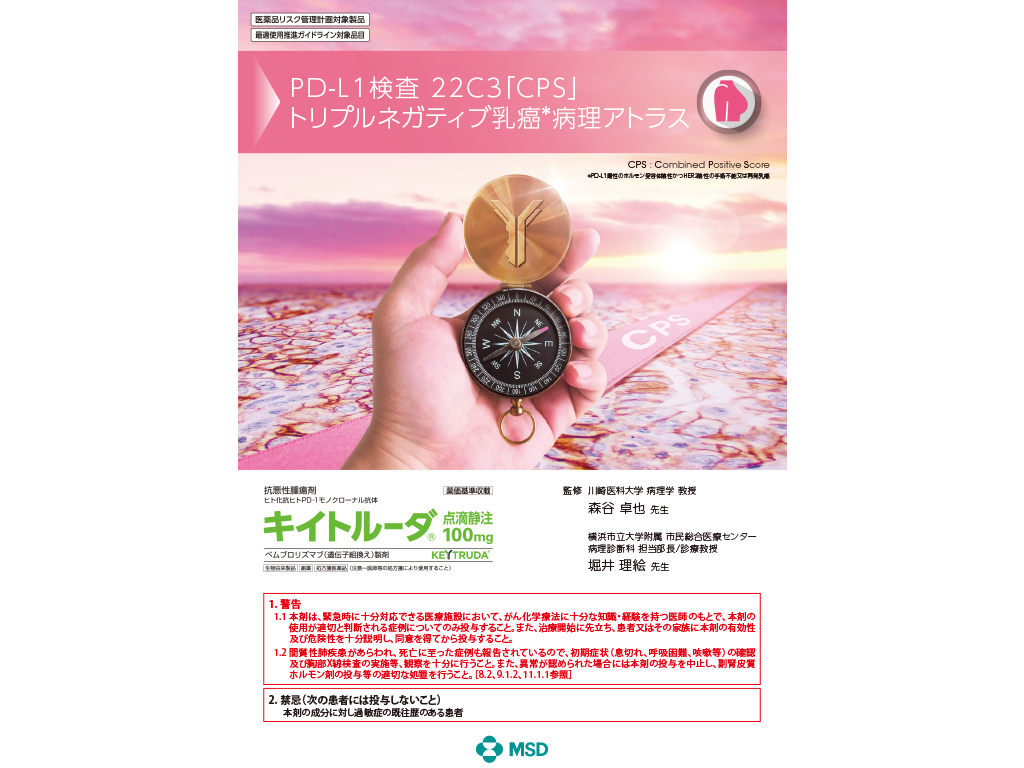 キイトルーダⓇPD-L1検査 22C3「CPS」病理アトラス：＜乳癌＞再発・転移