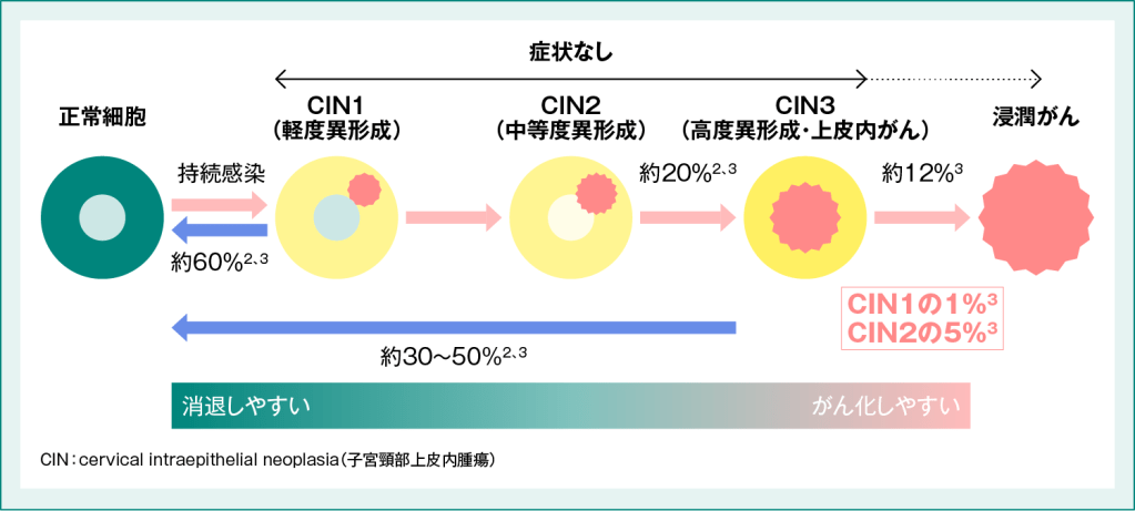 HPV感染と子宮頸がんへの進行1