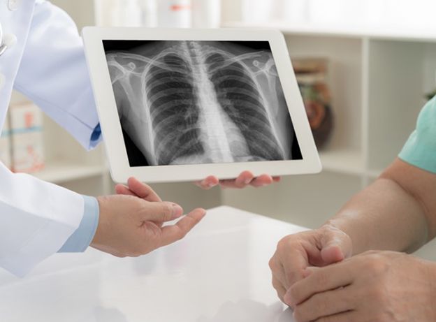 肺高血圧症領域