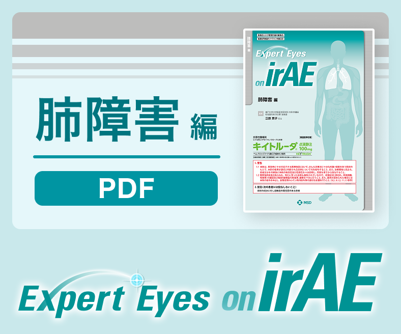 Expert Eyes on irAE 肺障害編 PDF