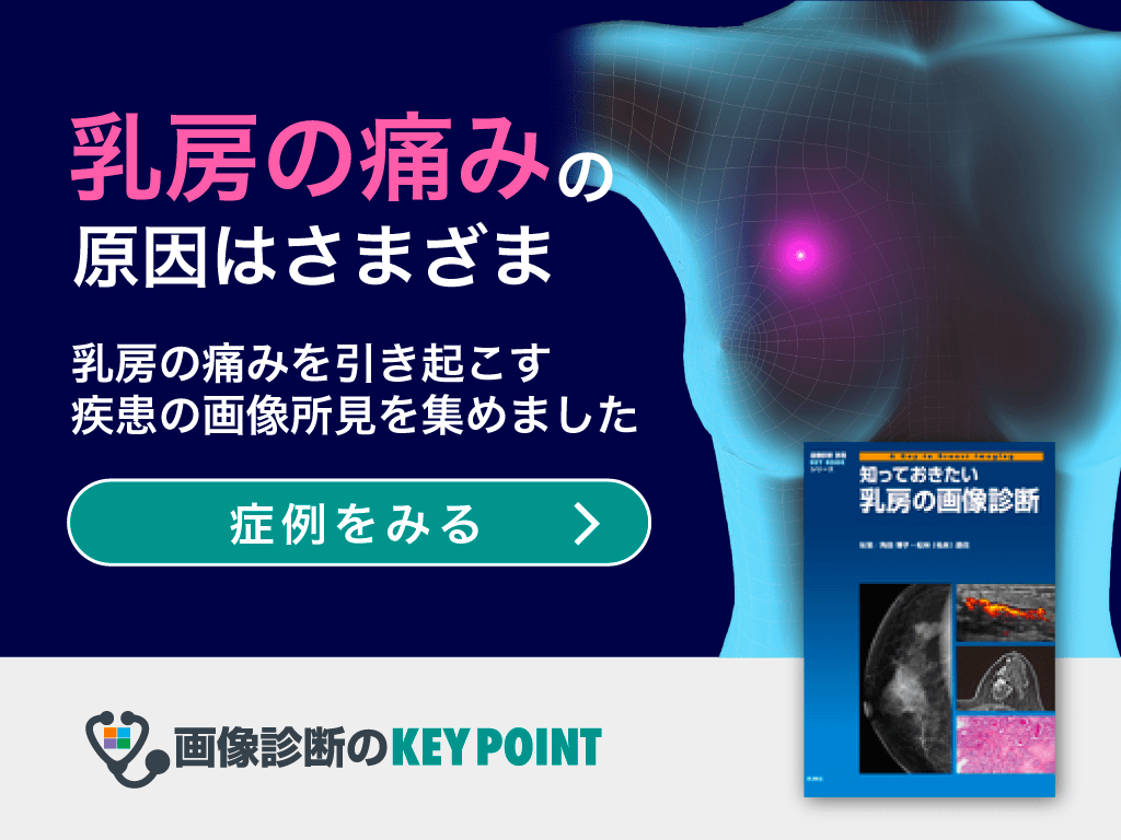 乳房の画像診断