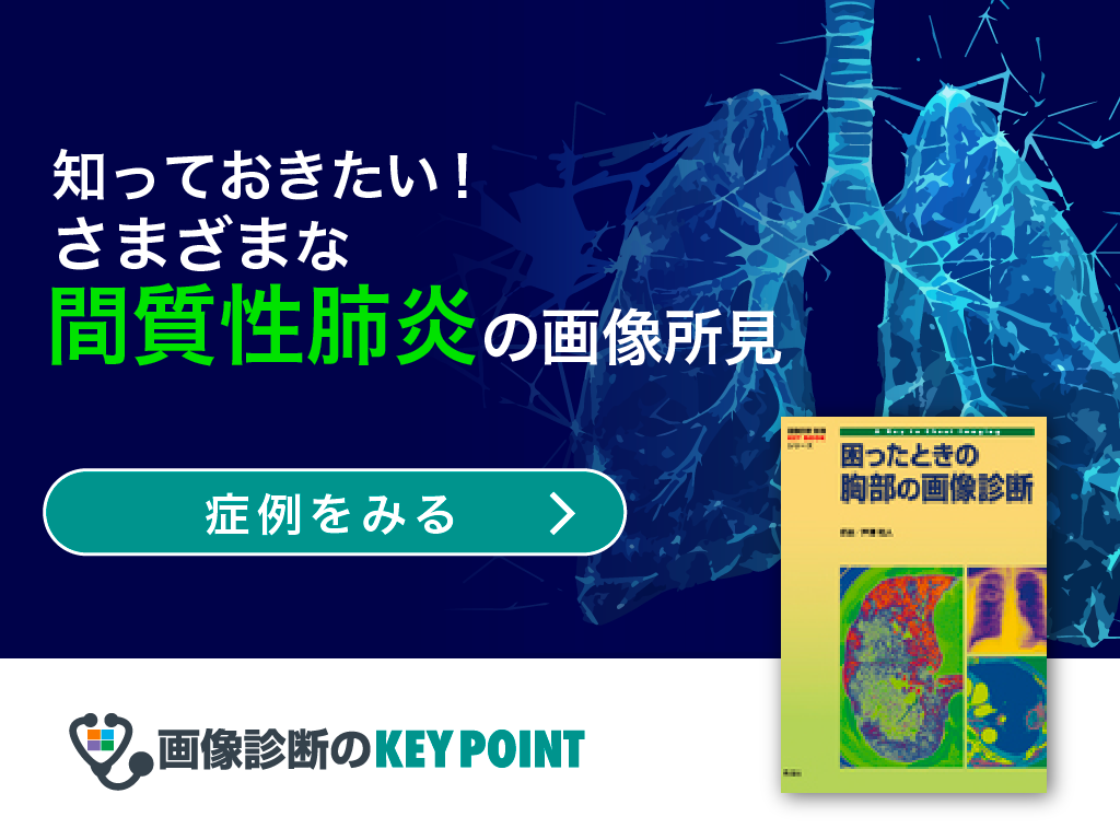 胸部の画像診断